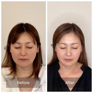 ベルガ 前田のエステ・リラクイメージ