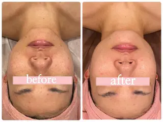 ♡RAYVIS♡ 名古屋店　神田のエステ・リラクイメージ