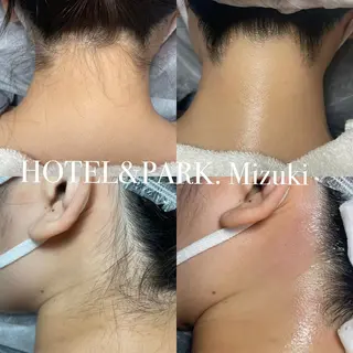 HOTEL&PARK . ワックス脱毛のエステ・リラクイメージ