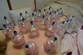 美容鍼灸女性専用 りんご鍼灸治療院のその他イメージ