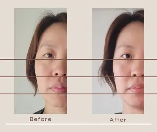 即効⚡小顔美容鍼🪡 むくみたるみ脂肪解消のエステ・リラクイメージ