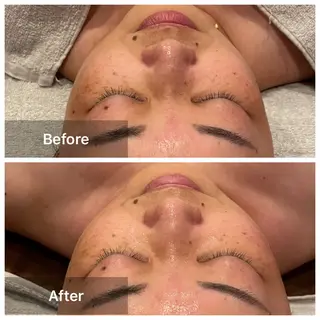 aide facial beauty所属・aide 肌質改善サロンのエステ・リラクイメージ