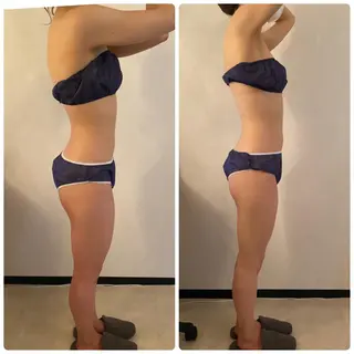 FLEUR大阪・整体 ・ハイフ・痩身・小顔のエステ・リラクイメージ