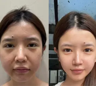 ネイル aliaハイフ&水光ジェットサロン所属・aliaハーブ水光店 エステティシャン募集のエステ・リラクイメージ