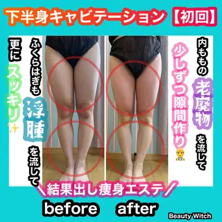 痩身/脱毛/ネイル HARUKAのエステ・リラクイメージ