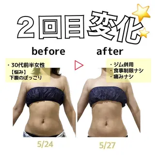 stella所属・stella都度払い 痩身小顔まつげパーマのマツエク・マツパデザイン