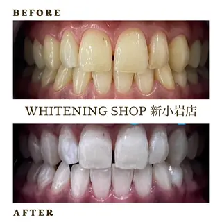 キッズ メンズ ホワイトニング ショップ新小岩店のその他イメージ