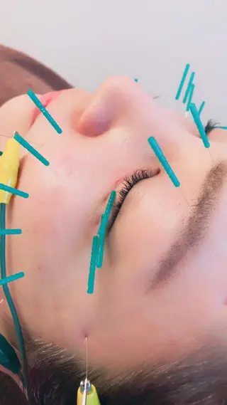 はりすたいる 鍼灸院のエステ・リラクイメージ