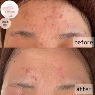 アンテインチル 山本のエステ・リラクイメージ