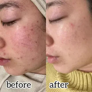 laluna saki...のその他イメージ