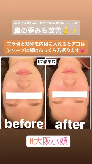 FLEUR大阪・美容 整体・痩身・小顔のエステ・リラクイメージ