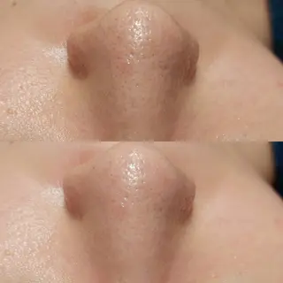 MyFairLady miuのエステ・リラクイメージ