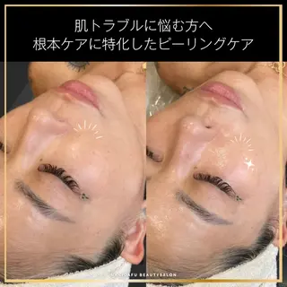 NANI OAFU所属・NANIOAFU [なんば店］のエステ・リラクイメージ