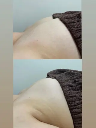 セルフエステエンリケ明石大久保店所属・夕希リンパ&痩身& 脱毛&毛穴ケアのエステ・リラクイメージ