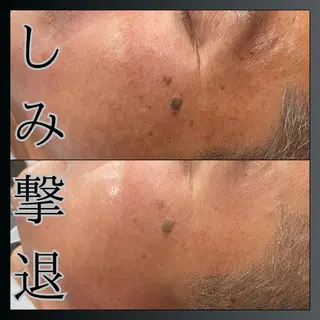 LiZA エステティックサロンのエステ・リラクイメージ