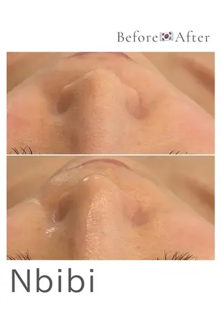 韓国🇰🇷価格 サロン_Nbibiのエステ・リラクイメージ