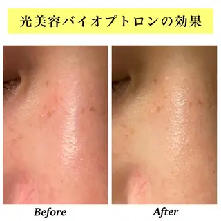 Bellesthe (ベルエステ)のエステ・リラクイメージ