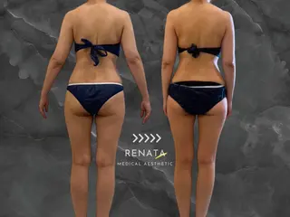 RENATA🕊 脂肪冷却専門店六本木のエステ・リラクイメージ