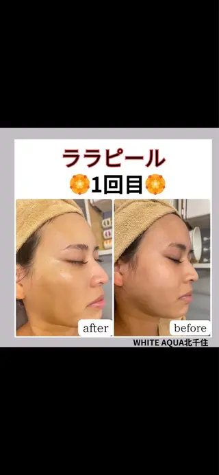 WHITE AQUA 北千住店のエステ・リラクイメージ