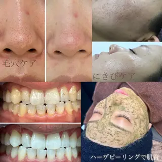 ホワイトニング・ハーブピーリング・フェイシャルサロンSUN所属・SUN MIWAのエステ・リラクイメージ
