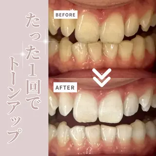 LIBRA自由が丘所属・LIBRA自由が丘 ホワイトニングのその他イメージ