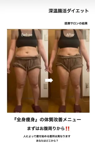 luana-ルアナ-所属・寝ながら痩せる ケアカフェluanaのエステ・リラクイメージ