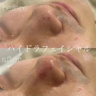 フェイシャルサロン CHIARA 荒田のエステ・リラクイメージ