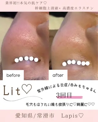 AROMA×CLAY Lapis所属・Lapis maikaのエステ・リラクイメージ