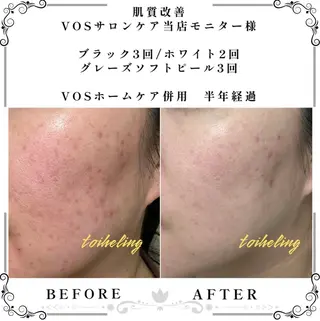 肌質改善サロン　toihealing所属・肌質改善サロン トワヒーリングのエステ・リラクイメージ
