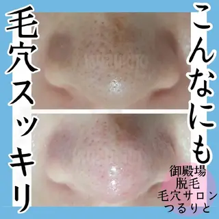 美肌脱毛サロン つるりと御殿場店所属・美肌脱毛サロン つるりとのその他イメージ