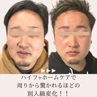 メンズ 第一印象専門サロン ADISEのエステ・リラクイメージ