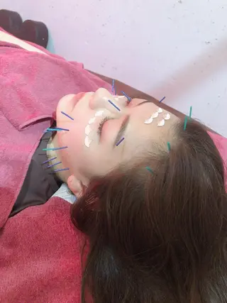 美容鍼灸女性専用 りんご鍼灸治療院のその他イメージ
