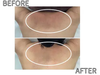 ハーブピーリング LIME池袋東口のエステ・リラクイメージ