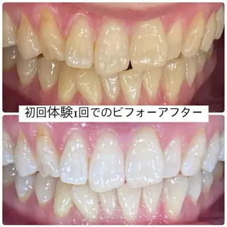 PLATINUM Beauty 横浜店所属・ホワイトニングルーム 横浜店のその他イメージ