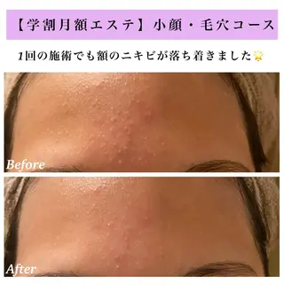 Bellesthe (ベルエステ)のエステ・リラクイメージ