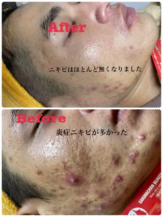 ニキビ、痩身、脱毛、 サクラチャンスパのエステ・リラクイメージ