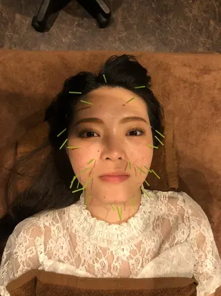 美容鍼灸サロン LOMIHARIのエステ・リラクイメージ