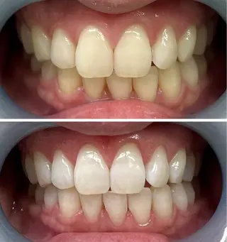 セルフホワイトニングサロンMW 錦糸町店所属・セルフホワイトニング サロンMW錦糸町店のその他イメージ