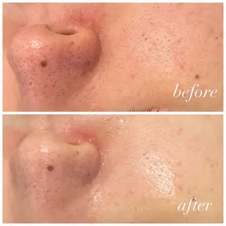 🦋美肌サロン. maho🦋のエステ・リラクイメージ