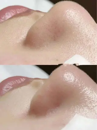 カラー パーマ ヘアアレンジ メンズ キッズ ネイル マツエク・マツパ アイブロウ Einami 美肌痩身サロンのエステ・リラクイメージ