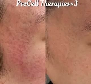 メンズ Blooming所属・LOUISE. ／肌質・頭皮のエステ・リラクイメージ