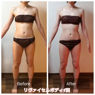 未病ケアサロン EMINY所属・未病ケアサロン EMINY☺︎勝俣のエステ・リラクイメージ