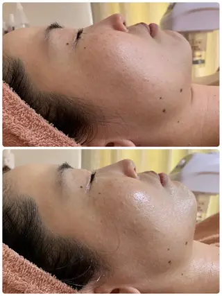 肌質改善専門店/絹々(きぬ)所属・心満たされる ハーブピーリング絹々のエステ・リラクイメージ