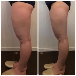 FLEUR大阪・美容 整体・痩身・小顔のエステ・リラクイメージ