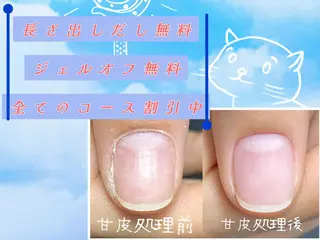 ネイル NFY-あや nailforyouのネイルデザイン