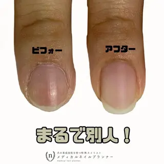 ネイル tsuki elfのエステ・リラクイメージ