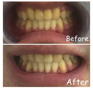 メンズ エマニエル USAのエステ・リラクイメージ