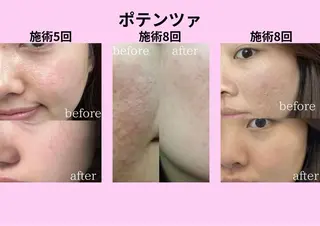 マツエク・マツパ aliaハイフ&水光ジェットサロン所属・aliaハーブ水光店 エステティシャン募集のエステ・リラクイメージ