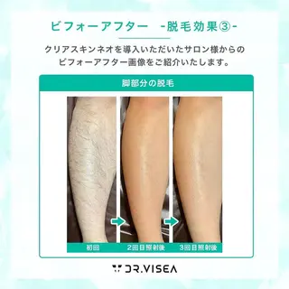 メンズ メンズサロンGRACE所属・salon GRACEのエステ・リラクイメージ