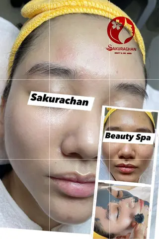 ニキビ、痩身、脱毛、 サクラチャンスパのエステ・リラクイメージ